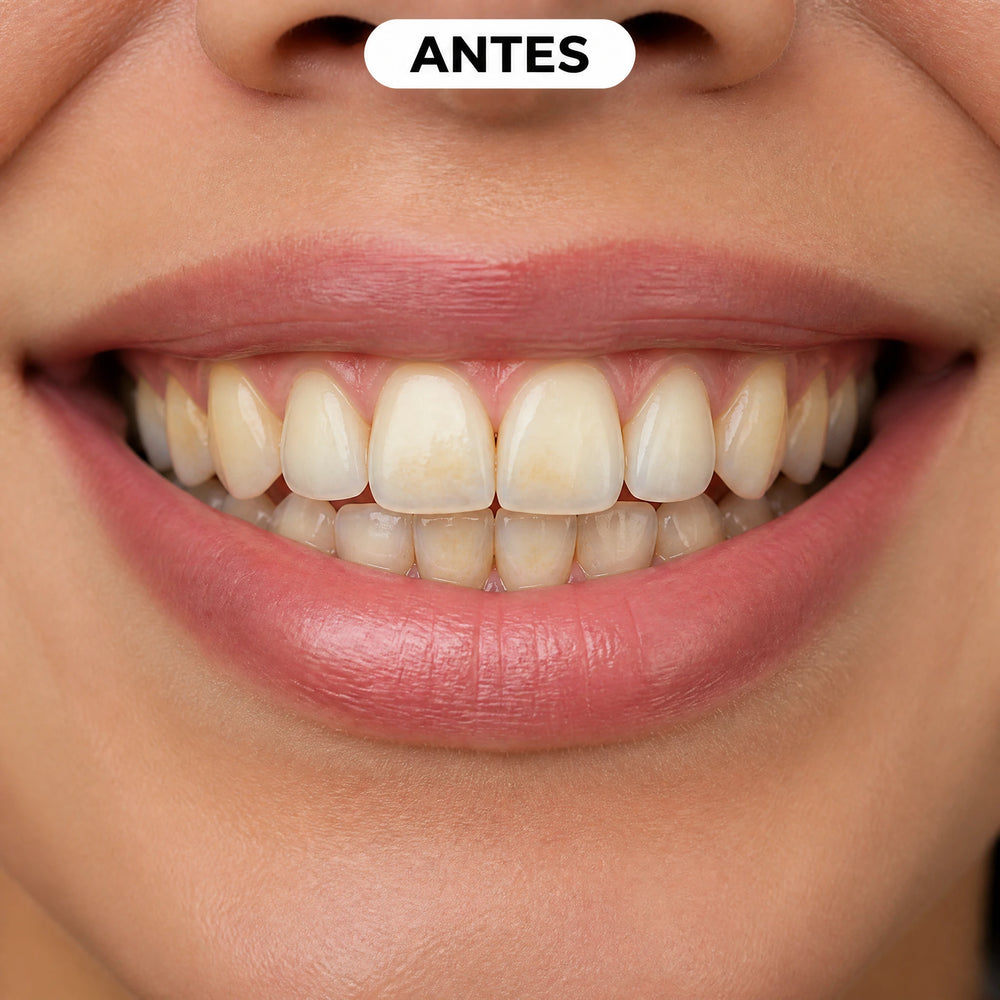 amarela-yasenshi-gel-blanqueador-antes.webp